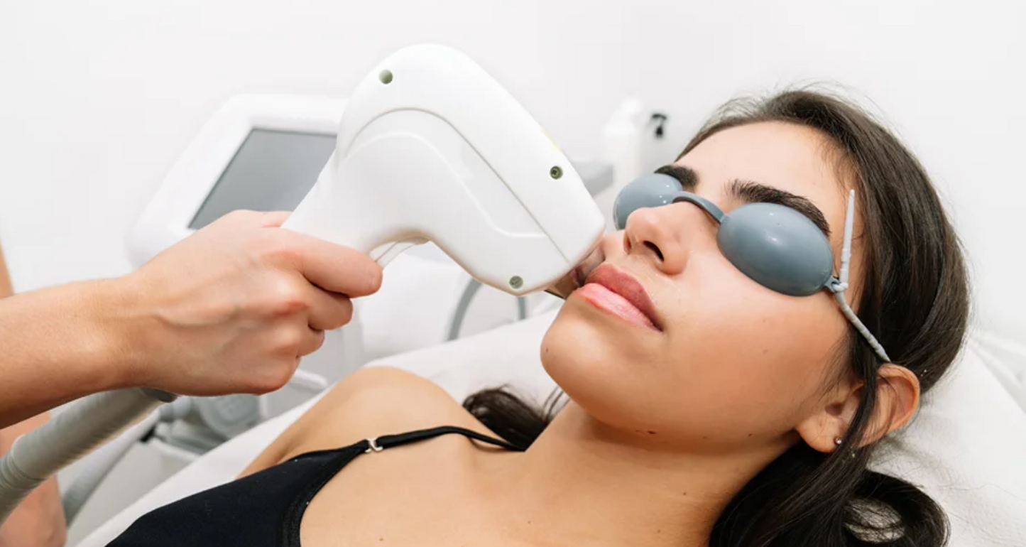 Laser hair removal - Full face - Nuneaton