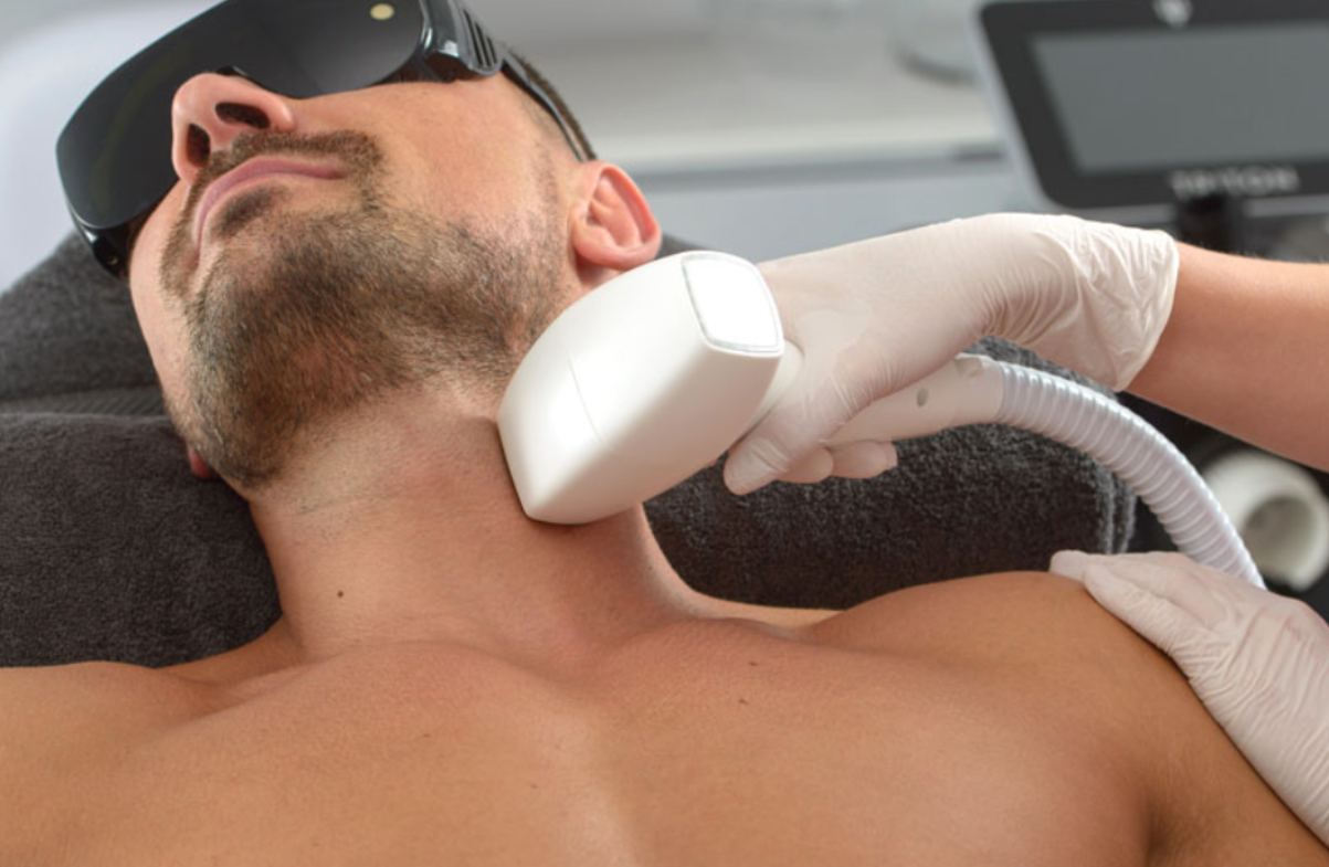 Laser hair removal - Neck - Nuneaton