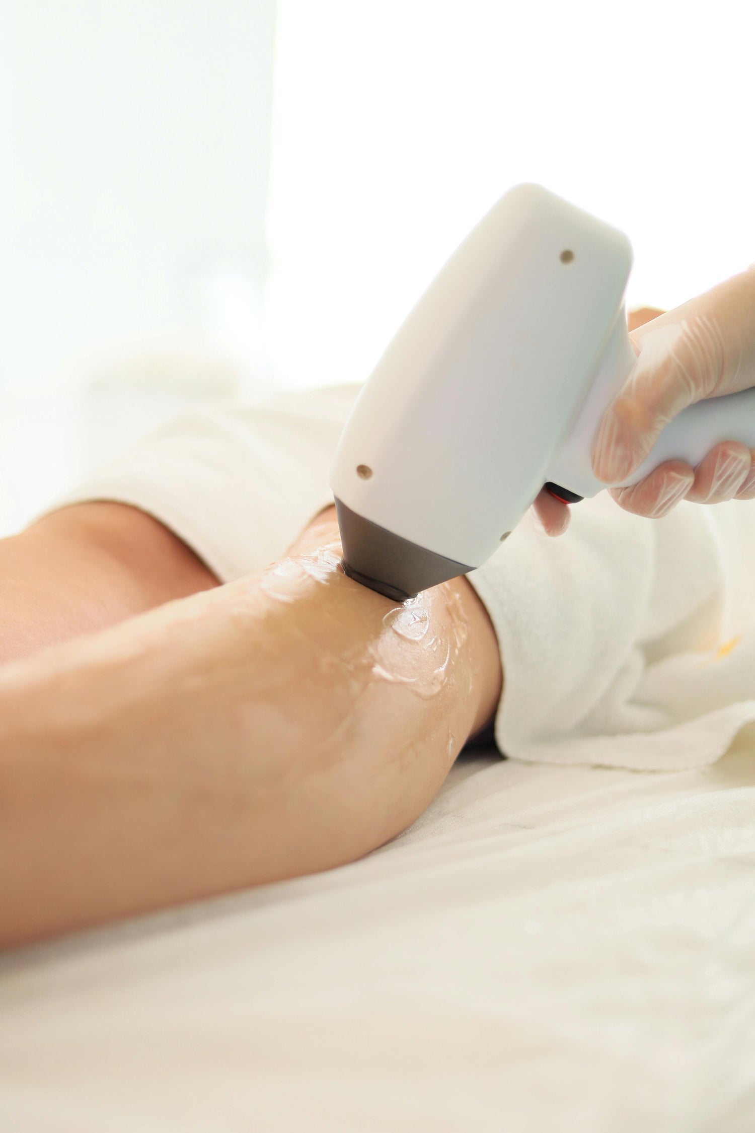 Laser hair removal in nuneaton