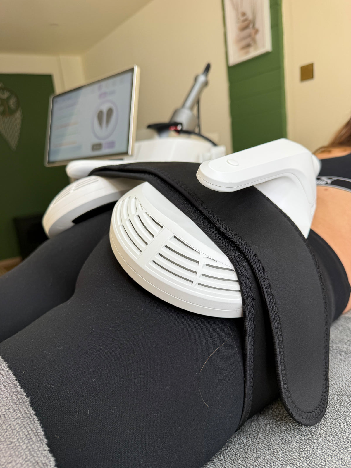 Sculpt and Tone EMS + ENDOSPHERE Combi Body Contouring Program