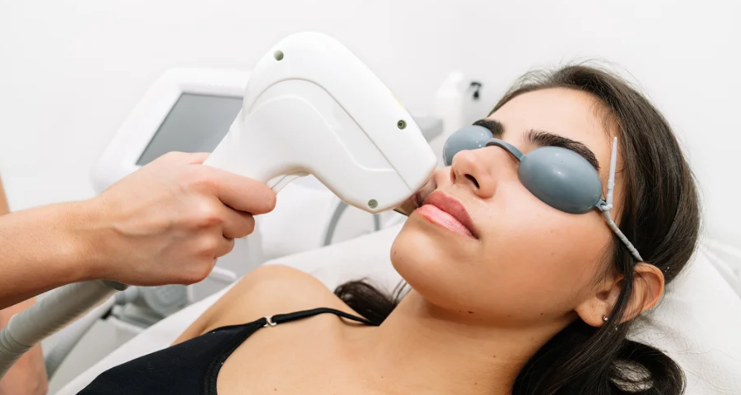 Laser hair removal - Full face - Nuneaton 